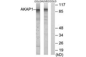 Western Blotting (WB) image for anti-A Kinase (PRKA) Anchor Protein 1 (AKAP1) (AA 281-330) antibody (ABIN2889701) (AKAP1 Antikörper  (AA 281-330))