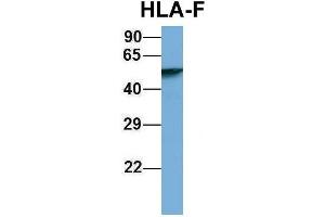 Host:  Rabbit  Target Name:  HLA-F  Sample Type:  Human Fetal Lung  Antibody Dilution:  1. (HLA-F Antikörper  (N-Term))