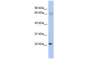 RPL18 antibody used at 1 ug/ml to detect target protein.