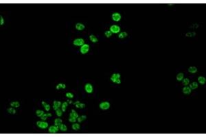 Immunofluorescent analysis of HepG2 cells using ABIN7139618 at dilution of 1:100 and Alexa Fluor 488-congugated AffiniPure Goat Anti-Rabbit IgG(H+L) (Histone H1.5 Antikörper  (pSer188))