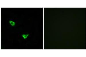 Immunofluorescence analysis of MCF-7 cells, using CHSS2 antibody.