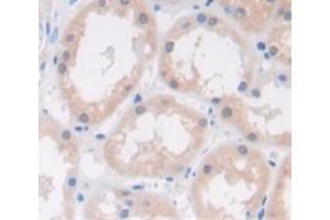 Figure. (Ribonuclease A6 Antikörper  (AA 25-150))