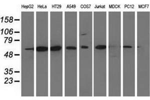 Western blot analysis of extracts (35 µg) from 9 different cell lines by using anti-CD80 monoclonal antibody. (CD80 Antikörper)