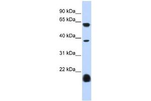 Serotonin receptor 3E antibody used at 1 ug/ml to detect target protein. (HTR3E Antikörper)