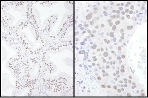Immunohistochemistry (IHC) image for anti-SUMO1 Activating Enzyme Subunit 2 (UBA2) (AA 525-575) antibody (ABIN7453775)