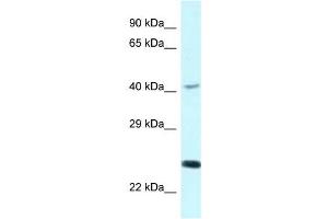 Western Blot showing CD244 antibody used at a concentration of 1 ug/ml against COLO205 Cell Lysate (2B4 Antikörper  (C-Term))