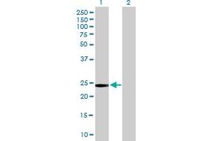 Western Blot analysis of GSTT2 expression in transfected 293T cell line by GSTT2 MaxPab polyclonal antibody.