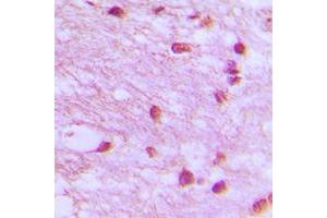 Immunohistochemical analysis of DNA Ligase 4 staining in human brain formalin fixed paraffin embedded tissue section. (LIG4 Antikörper  (Center))