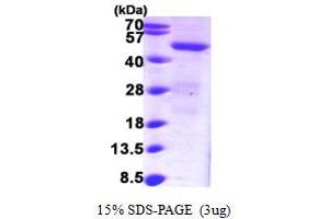 SDS-PAGE (SDS) image for Sorting Nexin 1 (SNX1) (AA 146-522) protein (His tag) (ABIN7529157) (Sorting Nexin 1 Protein (SNX1) (AA 146-522) (His tag))