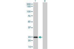 Western Blot analysis of NUDT5 expression in transfected 293T cell line by NUDT5 monoclonal antibody (M04), clone 2A3. (NUDT5 Antikörper  (AA 120-219))