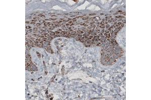 Immunohistochemical staining (Formalin-fixed paraffin-embedded sections) of human skin with CS monoclonal antibody, clone CL2545  shows granular cytoplasmic immunoreactivity in epithelial cells. (CS Antikörper)