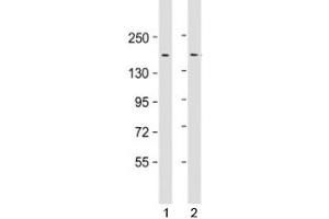 Western blot testing of human 1) HeLa and 2) SW480 cell lysate with LAP2 antibody at 1:1000.
