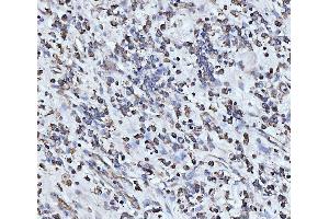 IHC analysis of PDCD4 using anti-PDCD4 antibody (ABIN5518943). (PDCD4 Antikörper  (AA 346-446))