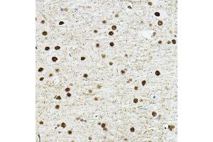 Immunohistochemistry (IHC) image for anti-TEA Domain Family Member 1 (SV40 Transcriptional Enhancer Factor) (TEAD1) (AA 135-215) antibody (ABIN6148982)