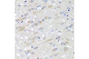 Immunohistochemistry of paraffin-embedded rat brain using NDUFS3 antibody.