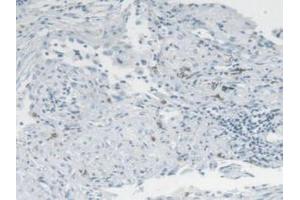 IHC-P analysis of Mouse Lung Tissue, with DAB staining. (CMA1 Antikörper  (AA 9-247))