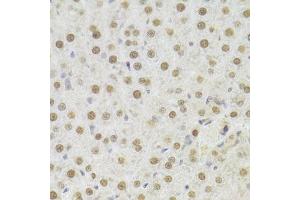Immunohistochemistry of paraffin-embedded rat liver using HDGF Antibody. (HDGF Antikörper  (AA 1-240))