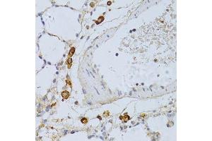 Immunohistochemistry of paraffin-embedded rat lung using PHGDH antibody. (PHGDH Antikörper  (AA 264-533))