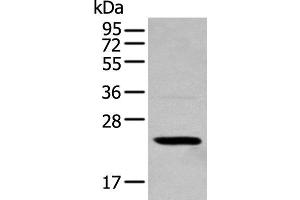 Western blot analysis of 293T cell using TCEAL4 Polyclonal Antibody at dilution of 1:250 (TCEAL4 Antikörper)