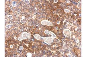Immunohistochemistry (IHC) image for anti-Src-Like-Adaptor (SLA) antibody (ABIN2856970)