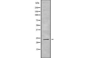 Western blot analysis of RAB19 using HT29 whole cell lysates (RAB19 Antikörper  (Internal Region))