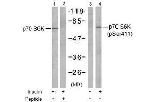 Image no. 2 for anti-Ribosomal Protein S6 Kinase, 70kDa, Polypeptide 1 (RPS6KB1) (pSer411) antibody (ABIN197035) (RPS6KB1 Antikörper  (pSer411))