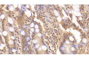 Immunohistochemistry (IHC) image for anti-Wingless-Type MMTV Integration Site Family, Member 3A (WNT3A) (AA 1-290) antibody (ABIN7427264)