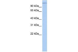 MTUS1 antibody used at 1 ug/ml to detect target protein. (MTUS1 Antikörper  (Middle Region))