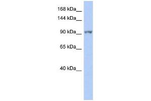 NEK9 antibody used at 1 ug/ml to detect target protein. (NEK9 Antikörper)