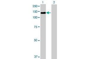 Lane 1: HDAC4 transfected lysate ( 106. (HDAC4 293T Cell Transient Overexpression Lysate(Denatured))