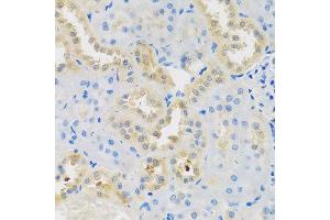 Immunohistochemistry of paraffin-embedded rat kidney using DNAL1 antibody at dilution of 1:100 (x40 lens).
