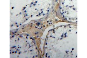Used in DAB staining on fromalin fixed paraffin-embedded testis tissue (Insulin Like Protein 3 (AA 2-129) Antikörper)