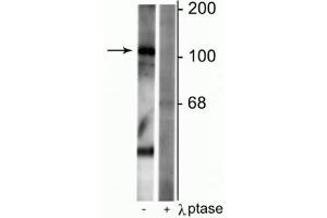 Western blot of rat synaptic membrane lysate showing specific immunolabeling of the ~102 kDa GABAB R1 protein phosphorylated at Ser923 in the first lane (-). (GABBR1 Antikörper  (pSer923))