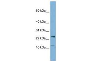 Image no. 1 for anti-Protein Phosphatase 1, Regulatory (Inhibitor) Subunit 11 (PPP1R11) (N-Term) antibody (ABIN6741758) (PPP1R11 Antikörper  (N-Term))