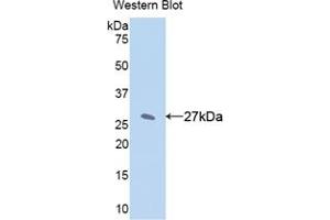 Western blot analysis of the recombinant protein. (CYP1A2 Antikörper  (AA 2-231))