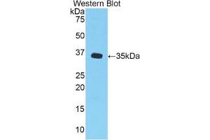 Western blot analysis of the recombinant protein. (CXCL1 Antikörper  (AA 25-96))