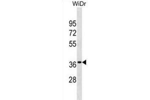 OR6K3 Antibody (N-term) (ABIN1881608 and ABIN2838717) western blot analysis in WiDr cell line lysates (35 μg/lane). (OR6K3 Antikörper  (N-Term))