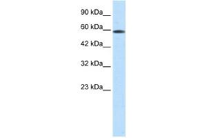 WB Suggested Anti-ASH2L Antibody Titration:  0. (ASH2L Antikörper  (N-Term))