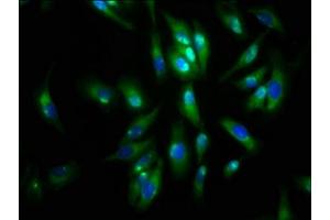 Immunofluorescence staining of Hela cells with ABIN7143601 at 1:133, counter-stained with DAPI. (AGRN Antikörper  (AA 968-1130))
