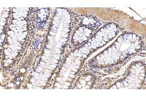 Immunohistochemistry (IHC) image for anti-Interleukin 1 Receptor Antagonist (IL1RN) (AA 26-177) antibody (ABIN7425773)