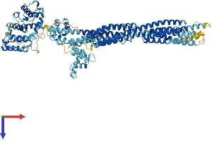 alpha Actinin 4 Protein (AA 1-911) (His tag)