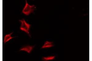 ABIN6275776 staining Hela by IF/ICC. (IL18R1 Antikörper  (Internal Region))