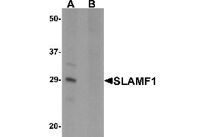 Western blot analysis of SLAMF1 in rat colon tissue lysate with SLAMF1 antibody at 1 µg/mL in (A) the absence and (B) the presence of blocking peptide.