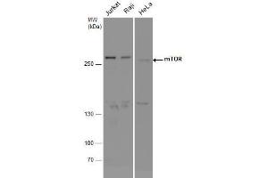 WB Image mTOR antibody detects mTOR protein by western blot analysis. (MTOR Antikörper  (Internal Region))
