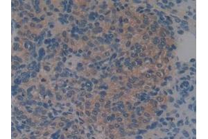 Detection of S100A6 in Mouse Ovary Tissue using Monoclonal Antibody to S100 Calcium Binding Protein A6 (S100A6) (S100A6 Antikörper  (AA 1-89))