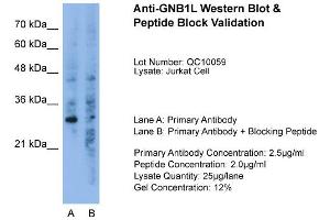 Host:  Rabbit  Target Name:  GNB1L  Sample Type:  Jurkat  Lane A:  Primary Antibody  Lane B:  Primary Antibody + Blocking Peptide  Primary Antibody Concentration:  2. (GNB1L Antikörper  (C-Term))