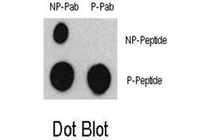 Dot blot analysis of ATF2 (phospho S322) polyclonal antibody  and ATF2 Non Phospho-specific Pab on nitrocellulose membrane. (ATF2 Antikörper  (pSer322, pSer340))
