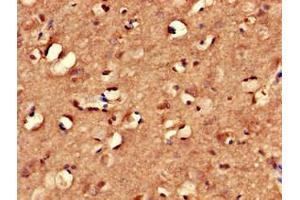 Immunohistochemistry of paraffin-embedded human brain tissue using ABIN7166940 at dilution of 1:100 (MYRIP Antikörper  (AA 387-689))