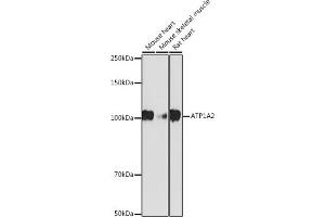 Western blot analysis of extracts of various cell lines, using  antibody (ABIN7265769) at 1:1000 dilution. (ATP1A2 Antikörper)