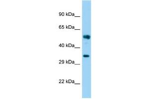 Host: Rabbit Target Name: FAM49B Sample Type: Fetal Brain lysates Antibody Dilution: 1. (FAM49B Antikörper  (N-Term))